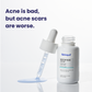 Pitstop Blue Serum