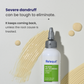 Dandruff Control Lotion